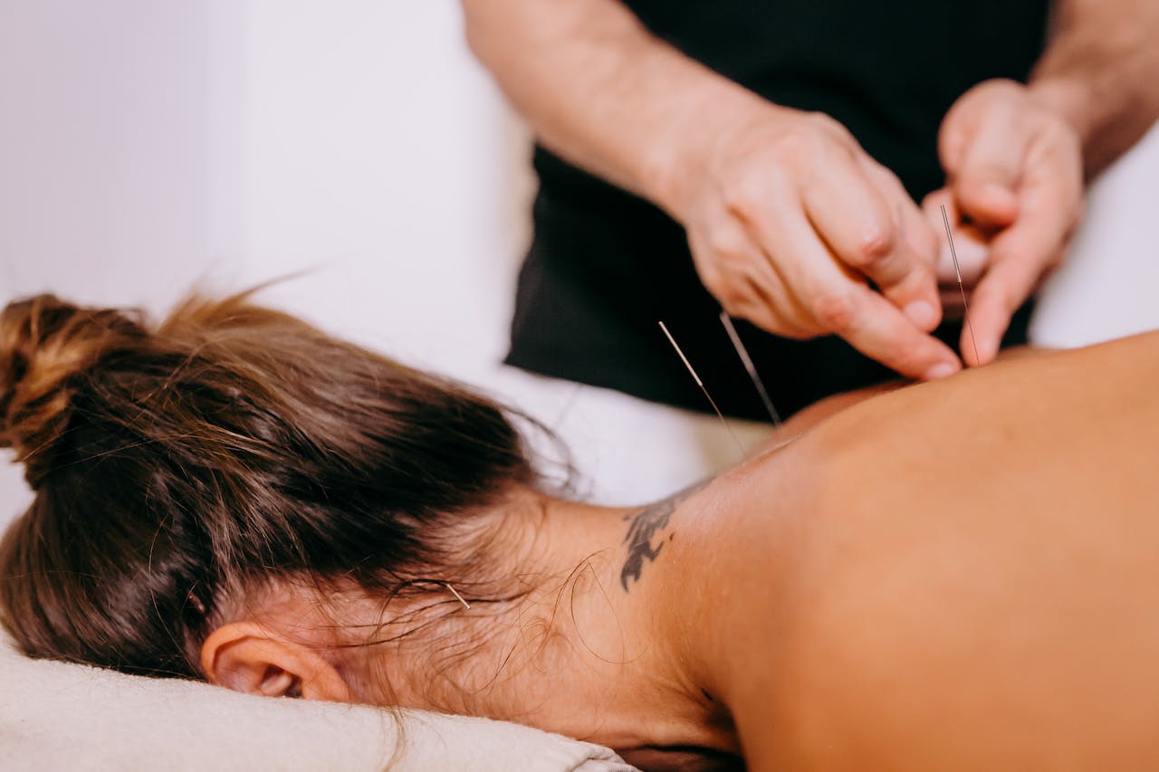 The Art of Healing: Exploring Acupuncture Benefits